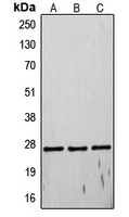 TIMP4 Antibody - Western blot analysis of TIMP4 expression in Sol8 (A); MCF7 (B); HeLa (C) whole cell lysates.