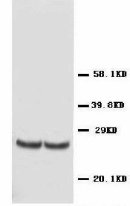 TIMP4 Antibody -  This image was taken for the unconjugated form of this product. Other forms have not been tested.