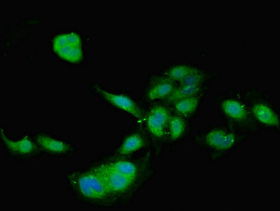 TIMP4 Antibody - Immunofluorescent analysis of Hela cells using TIMP4 Antibody at dilution of 1:100 and Alexa Fluor 488-congugated AffiniPure Goat Anti-Rabbit IgG(H+L)