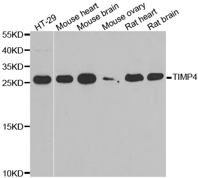 TIMP4 Antibody - Western blot analysis of extracts of various cell lines.