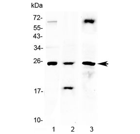 TIMP4 Antibody - Western blot testing of 1) rat heart, 2) mouse heart and 3) human HeLa lysate with TIMP4 antibody at 0.5ug/ml. Predicted molecular weight ~25 kDa.
