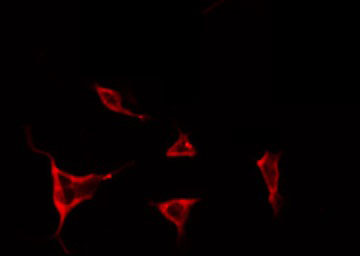 TIMP4 Antibody - Staining NIH-3T3 cells by IF/ICC. The samples were fixed with PFA and permeabilized in 0.1% Triton X-100, then blocked in 10% serum for 45 min at 25°C. The primary antibody was diluted at 1:200 and incubated with the sample for 1 hour at 37°C. An Alexa Fluor 594 conjugated goat anti-rabbit IgG (H+L) Ab, diluted at 1/600, was used as the secondary antibody.
