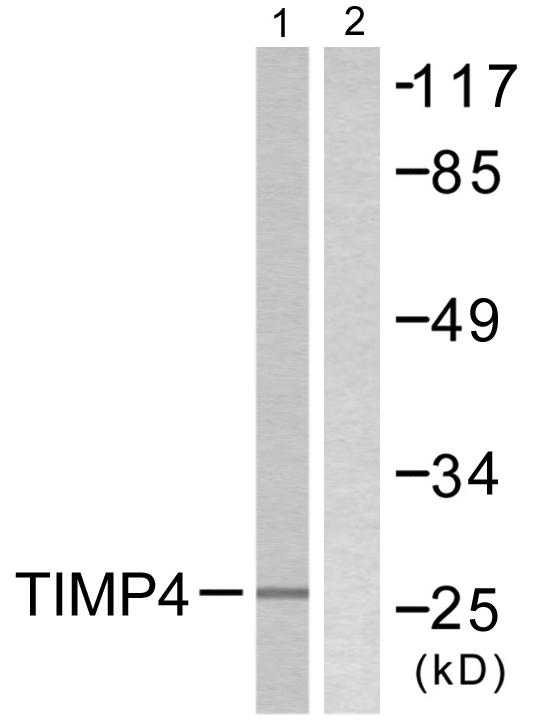 TIMP4 Antibody - Western blot analysis of extracts from NIH/3T3 cells, using TIMP4 antibody.