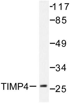 TIMP4 Antibody - Western blot of TIMP4 (S206) pAb in extracts from NIH/3T3 cells.