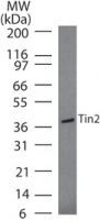 Tin / Tin-2 Antibody - Western blot of Tin2 in Daudi cell lysate using antibody at 2 ug/ml.