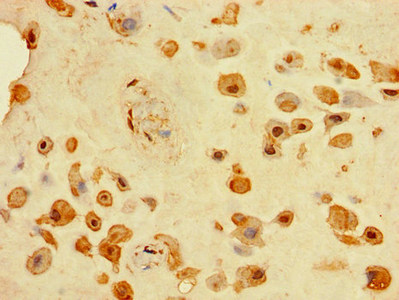 TINAGL1 / Lipocalin 7 Antibody - Immunohistochemistry of paraffin-embedded human placenta tissue using TINAGL1 Antibody at dilution of 1:100