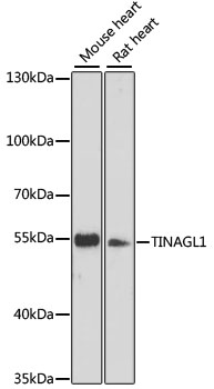 TINAGL1 / Lipocalin 7 Antibody - Western blot analysis of extracts of various cell lines, using TINAGL1 antibody at 1:3000 dilution. The secondary antibody used was an HRP Goat Anti-Rabbit IgG (H+L) at 1:10000 dilution. Lysates were loaded 25ug per lane and 3% nonfat dry milk in TBST was used for blocking. An ECL Kit was used for detection and the exposure time was 30s.