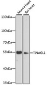 TINAGL1 / Lipocalin 7 Antibody - Western blot analysis of extracts of various cell lines, using TINAGL1 antibody at 1:3000 dilution. The secondary antibody used was an HRP Goat Anti-Rabbit IgG (H+L) at 1:10000 dilution. Lysates were loaded 25ug per lane and 3% nonfat dry milk in TBST was used for blocking. An ECL Kit was used for detection and the exposure time was 30s.
