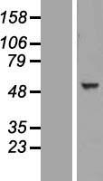 TINAGL1 / Lipocalin 7 Protein - Western validation with an anti-DDK antibody * L: Control HEK293 lysate R: Over-expression lysate