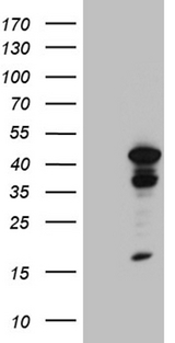 TINF2 Antibody - HEK293T cells were transfected with the pCMV6-ENTRY control. (Left lane) or pCMV6-ENTRY TINF2. (Right lane) cDNA for 48 hrs and lysed. Equivalent amounts of cell lysates. (5 ug per lane) were separated by SDS-PAGE and immunoblotted with anti-TINF2. (1:2000)