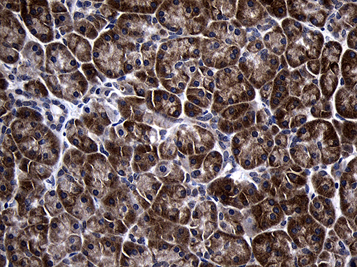 TINF2 Antibody - Immunohistochemical staining of paraffin-embedded Human pancreas tissue within the normal limits using anti-TINF2 mouse monoclonal antibody. (Heat-induced epitope retrieval by 1mM EDTA in 10mM Tris buffer. (pH8.5) at 120°C for 3 min. (1:150)(1:2000)