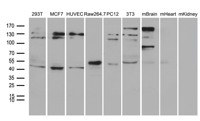 TINF2 Antibody - Western blot analysis of extracts. (35ug) from 6 different cell lines and 3 different tissue lines by using anti-TINF2 monoclonal antibody. (1:500)