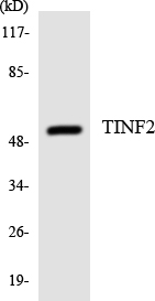 TINF2 Antibody - Western blot analysis of the lysates from HeLa cells using TINF2 antibody.