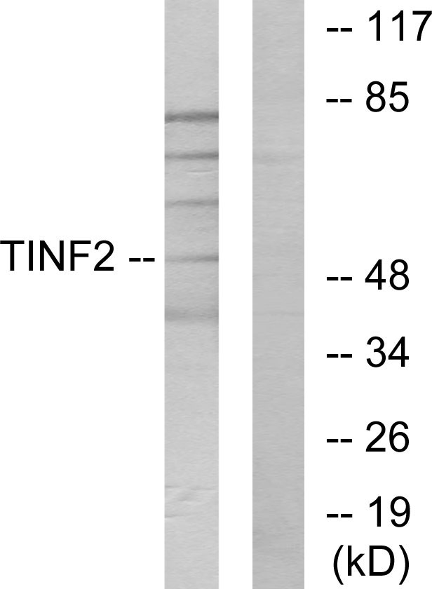 TINF2 Antibody - Western blot analysis of lysates from HUVEC cells, using TINF2 Antibody. The lane on the right is blocked with the synthesized peptide.