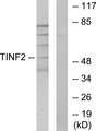 TINF2 Antibody - Western blot analysis of lysates from HUVEC cells, using TINF2 Antibody. The lane on the right is blocked with the synthesized peptide.