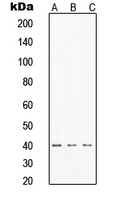 TINF2 Antibody - Western blot analysis of TIN2 expression in MCF7 (A); HeLa (B); Jurkat (C) whole cell lysates.