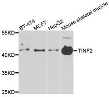 TINF2 Antibody - Western blot analysis of extracts of various cells.