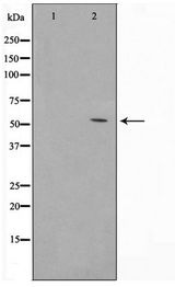TINF2 Antibody - Western blot of HUVEC cell lysate using TINF2 Antibody