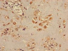 TINF2 Antibody - Immunohistochemistry image of paraffin-embedded human placenta tissue at a dilution of 1:100