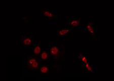 TINF2 Antibody - Staining HuvEc cells by IF/ICC. The samples were fixed with PFA and permeabilized in 0.1% Triton X-100, then blocked in 10% serum for 45 min at 25°C. The primary antibody was diluted at 1:200 and incubated with the sample for 1 hour at 37°C. An Alexa Fluor 594 conjugated goat anti-rabbit IgG (H+L) Ab, diluted at 1/600, was used as the secondary antibody.