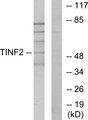 TINF2 Antibody - Western blot analysis of extracts from HUVEC cells, using TINF2 antibody.