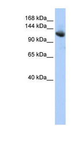 TIP120 / CAND1 Antibody - CAND1 antibody Western blot of HepG2 cell lysate. This image was taken for the unconjugated form of this product. Other forms have not been tested.
