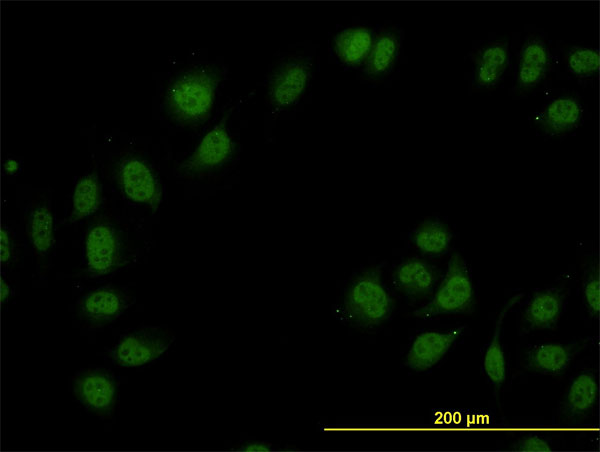 TIP120 / CAND1 Antibody - Immunofluorescence of monoclonal antibody to CAND1 on HeLa cell. [antibody concentration 10 ug/ml]