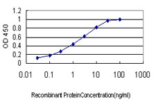 TIP120 / CAND1 Antibody - Detection limit for recombinant GST tagged CAND1 is approximately 0.03 ng/ml as a capture antibody.