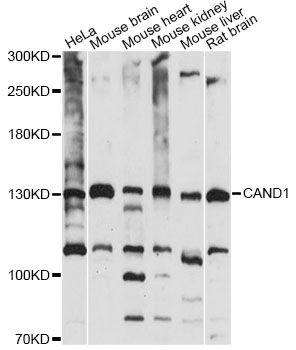 TIP120 / CAND1 Antibody - Western blot analysis of extracts of various cell lines, using CAND1 antibody at 1:1000 dilution. The secondary antibody used was an HRP Goat Anti-Rabbit IgG (H+L) at 1:10000 dilution. Lysates were loaded 25ug per lane and 3% nonfat dry milk in TBST was used for blocking. An ECL Kit was used for detection and the exposure time was 15s.