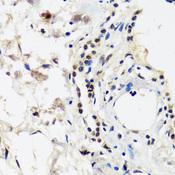 TIP120 / CAND1 Antibody - Immunohistochemistry of paraffin-embedded Human lung using CAND1 Polyclonal Antibody at dilution of 1:100 (40x lens).