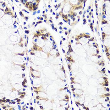 TIP120 / CAND1 Antibody - Immunohistochemistry of paraffin-embedded Human colon using CAND1 Polyclonal Antibody at dilution of 1:100 (40x lens).