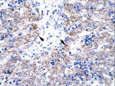 TIP30 / HTATIP2 Antibody - HTATIP2 / TIP30 antibody ARP32774_T100-NP_006401-HTATIP2 (HIV-1 Tat interactive protein 2, 30kDa) Antibody was used in IHC to stain formalin-fixed, paraffin-embedded human liver.  This image was taken for the unconjugated form of this product. Other forms have not been tested.