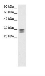 TIP30 / HTATIP2 Antibody - Jurkat Cell Lysate.  This image was taken for the unconjugated form of this product. Other forms have not been tested.