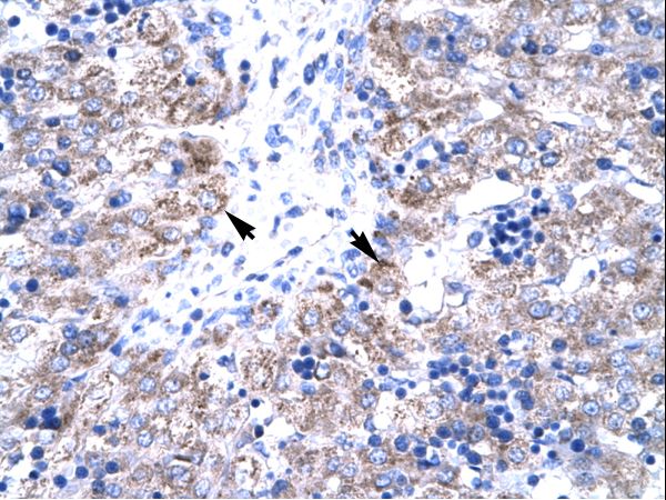 TIP30 / HTATIP2 Antibody - HTATIP2 / TIP30 antibody ARP32774_T100-NP_006401-HTATIP2 (HIV-1 Tat interactive protein 2, 30kDa) Antibody was used in IHC to stain formalin-fixed, paraffin-embedded human liver.  This image was taken for the unconjugated form of this product. Other forms have not been tested.