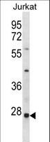 TIP30 / HTATIP2 Antibody - HTATIP2 Antibody western blot of Jurkat cell line lysates (35 ug/lane). The HTATIP2 antibody detected the HTATIP2 protein (arrow).