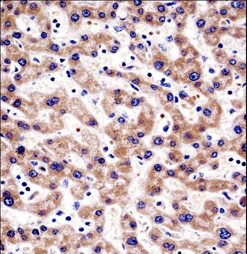 TIP30 / HTATIP2 Antibody - HTATIP2 Antibody immunohistochemistry of formalin-fixed and paraffin-embedded human liver tissue followed by peroxidase-conjugated secondary antibody and DAB staining.