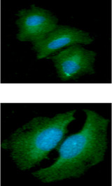 TIP30 / HTATIP2 Antibody - ICC/IF analysis of HTATIP2 in A549 cells line, stained with DAPI (Blue) for nucleus staining and monoclonal anti-human HTATIP2 antibody (1:100) with goat anti-mouse IgG-Alexa fluor 488 conjugate (Green).ICC/IF analysis of HTATIP2 in HeLa cells line, stained with DAPI (Blue) for nucleus staining and monoclonal anti-human HTATIP2 antibody (1:100) with goat anti-mouse IgG-Alexa fluor 488 conjugate (Green).