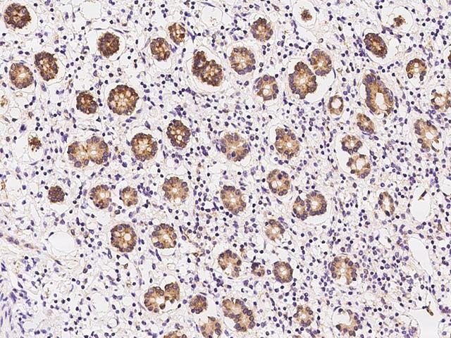 TIP30 / HTATIP2 Antibody - Immunochemical staining of human HTATIP2 in human small intestine with rabbit polyclonal antibody at 1:100 dilution, formalin-fixed paraffin embedded sections.