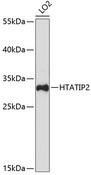 TIP30 / HTATIP2 Antibody - Western blot analysis of extracts of LO2 cells using HTATIP2 Polyclonal Antibody at dilution of 1:3000.