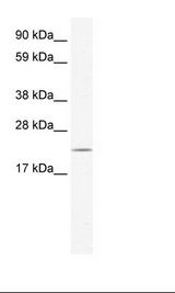 TIP30 / HTATIP2 Antibody - Fetal Liver Lysate.  This image was taken for the unconjugated form of this product. Other forms have not been tested.