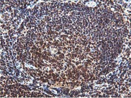 TIP48 / RUVBL2 Antibody - IHC of paraffin-embedded Human tonsil using anti-RUVBL2 mouse monoclonal antibody.