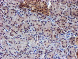 TIP48 / RUVBL2 Antibody - IHC of paraffin-embedded Human pancreas tissue using anti-RUVBL2 mouse monoclonal antibody.