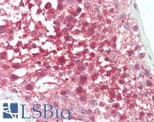 TIP48 / RUVBL2 Antibody - Human Testis: Formalin-Fixed, Paraffin-Embedded (FFPE).  This image was taken for the unconjugated form of this product. Other forms have not been tested.