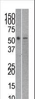 TIP48 / RUVBL2 Antibody - The anti-RUVBL21 antibody is used in Western blot to detect RUVBL2 in mouse kidney (left) and SK-Br-3 (right) tissue/cell line lysates.