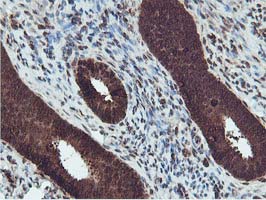 TIP48 / RUVBL2 Antibody - IHC of paraffin-embedded Human endometrium tissue using anti-RUVBL2 mouse monoclonal antibody.