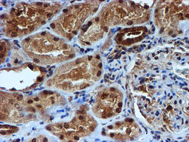 TIP48 / RUVBL2 Antibody - IHC of paraffin-embedded Human Kidney tissue using anti-RUVBL2 mouse monoclonal antibody.