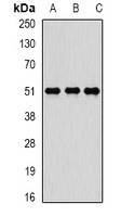 TIP48 / RUVBL2 Antibody - Western blot analysis of Reptin 52 expression in K562 (A); SW480 (B); MCF7 (C) whole cell lysates.