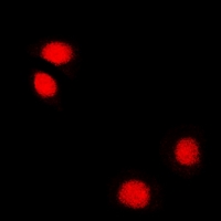 TIP48 / RUVBL2 Antibody - Immunofluorescent analysis of Reptin 52 staining in U2OS cells. Formalin-fixed cells were permeabilized with 0.1% Triton X-100 in TBS for 5-10 minutes and blocked with 3% BSA-PBS for 30 minutes at room temperature. Cells were probed with the primary antibody in 3% BSA-PBS and incubated overnight at 4 deg C in a humidified chamber. Cells were washed with PBST and incubated with a DyLight 594-conjugated secondary antibody (red) in PBS at room temperature in the dark.