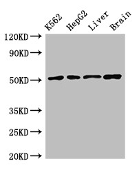 TIP48 / RUVBL2 Antibody - Positive WB detected in:K562 whole cell lysate,HepG2 whole cell lysate,Rat liver tissue,Mouse brain tissue;All lanes:RUVBL2 antibody at 2.4?g/ml;Secondary;Goat polyclonal to rabbit IgG at 1/50000 dilution;Predicted band size: 52,47 KDa;Observed band size: 52 KDa;