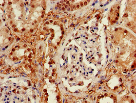 TIP48 / RUVBL2 Antibody - Immunohistochemistry of paraffin-embedded human kidney tissue using RUVBL2 Antibody at dilution of 1:100